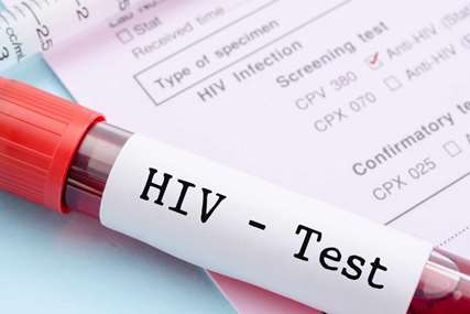 چه کسانی باید آزمایش ایدز بدهند؟